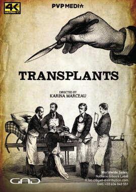 Poster of Transplants